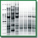 Молекулярное типирование уропатогенных штаммов Escherichia сoli, выделенных у пациентов с использованием метода REP-ПЦР 71